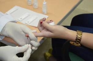 Teste rápido de HIV/AIDS (Foto: Divulgação/FMS)