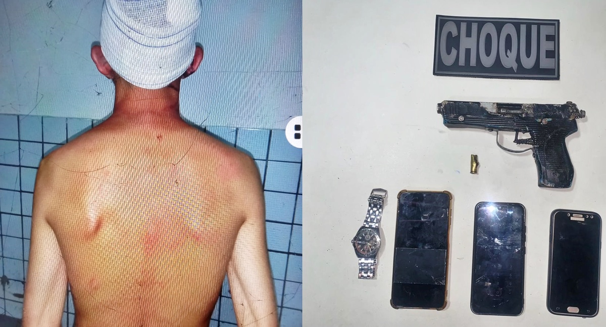 O suspeito foi detido e recebeu atendimento médico devido aos ferimentos