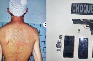 O suspeito foi detido e recebeu atendimento médico devido aos ferimentos (Foto: Divulgação / PMPI)