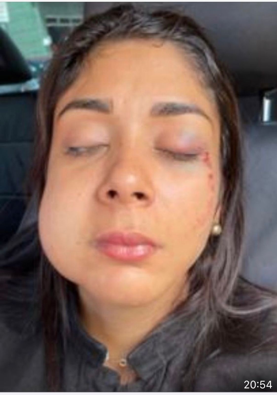 Pamela Xavier depois das agressões