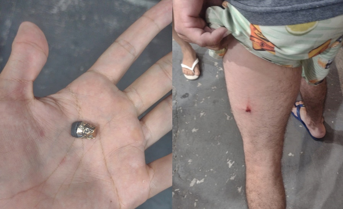 A vítima sofreu apenas um ferimento leve
