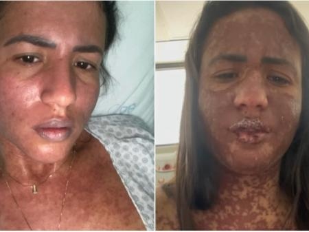 Carolina diz "achei que iria morrer"