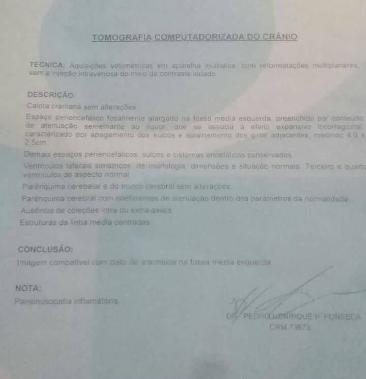 Laudo da Tomografia