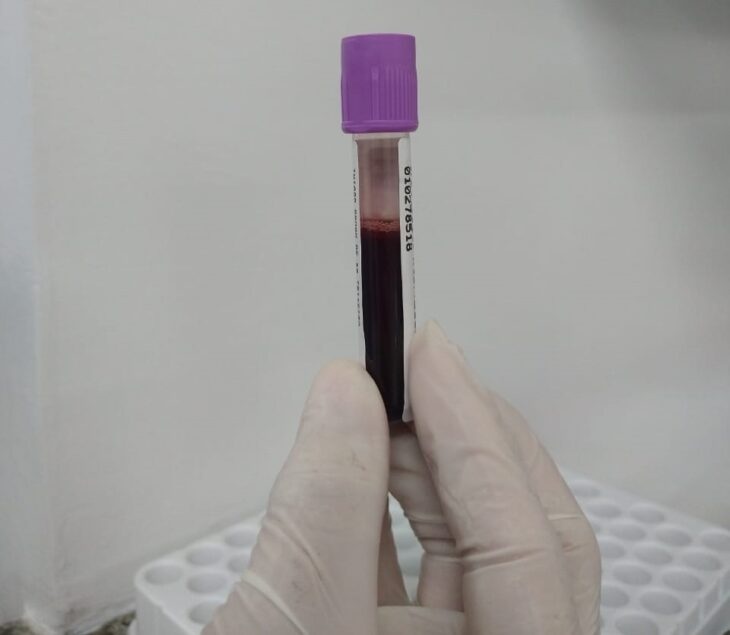 Doação de Medula Óssea