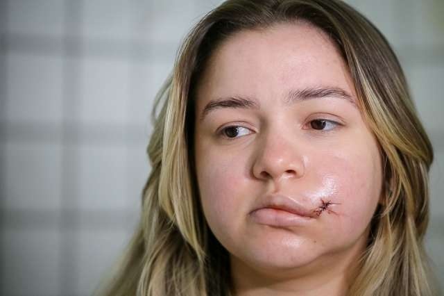 Mariana, atacada pelo síndico, sente dores, com dificuldades de ingerir água e alimentos