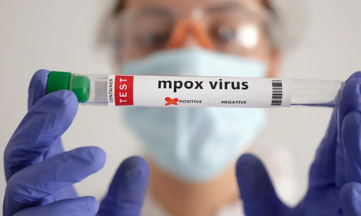 convoca comitê para reavaliar emergência global por mpox