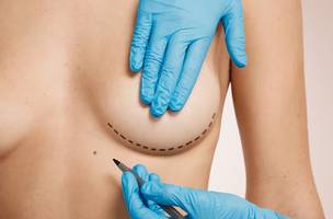 Mamoplastia (Foto: Reprodução/Freepik)