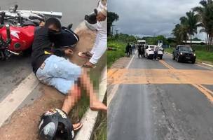 Motociclista levou um tiro na perna de uma equipe descaracterizada da Polícia (Foto: Reprodução)