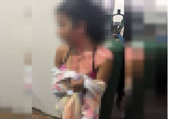 A garota sofreu várias queimaduras