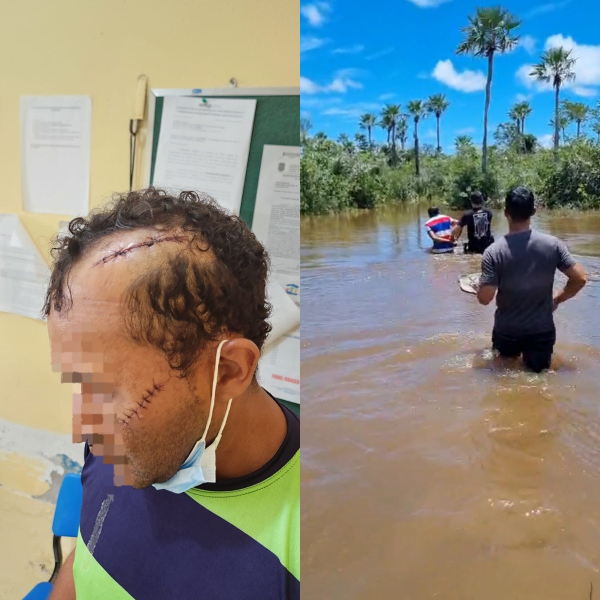 Do lado esquerdo, a vítima que sofreu três golpes, atingindo o rosto, a cabeça e o braço. No lado direito da imagem, o acusado sendo preso pela Polícia Civil