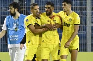 Maximiliano Olivera, do Peñarol, com corte no rosto e cheio de sangue, após ser atingido por objeto atirado pela torcida do Rosario Central (Foto: Marcelo Manera/AFP)