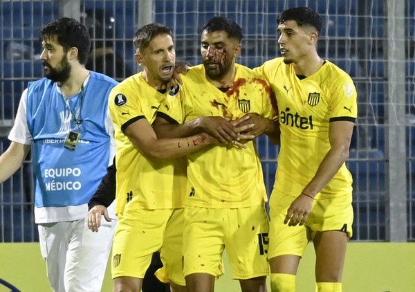 Maximiliano Olivera, do Peñarol, com corte no rosto e cheio de sangue, após ser atingido por objeto atirado pela torcida do Rosario Central