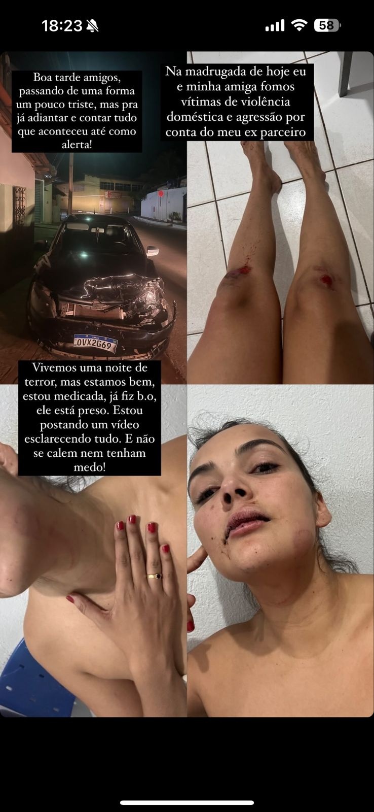 Fotos da vítima, Daniele Barroso após as agressões