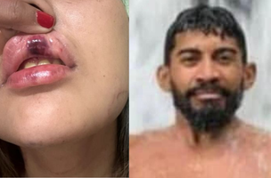 Vítima, Daniele Barroso e acusado, Valdevan Furtardo dos Santos (Foto: Reprodução/Redes Sociais)