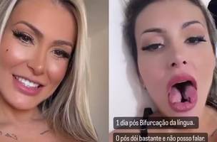 Andressa Urach choca a web ao mostrar língua bifurcada: “aumento de prazer” (Foto: Reprodução)