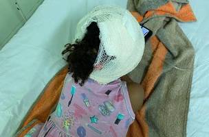 Criança foi mordida na região da cabeça e pescoço (Foto: Reprodução)