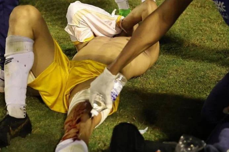 Goleiro no chão depois de sofrer disparo de um tiro com bala de borracha