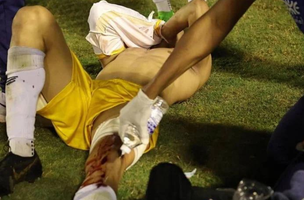 Goleiro no chão depois de sofrer disparo de um tiro com bala de borracha (Foto: Reprodução)