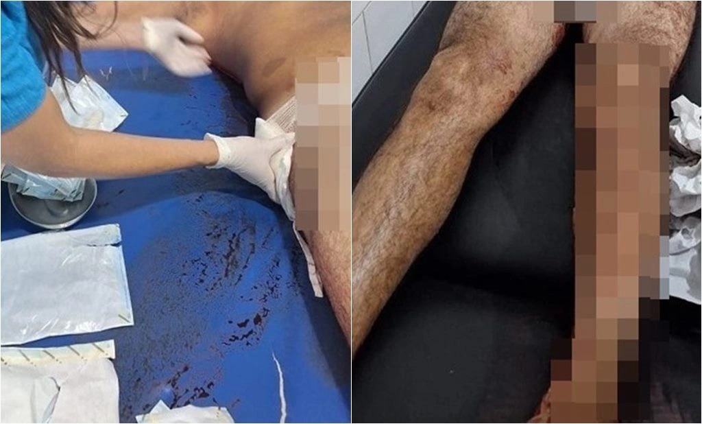 Irmãos são baleados ao tentarem tomar armas de policias em Regeneração