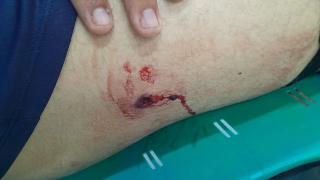 Mulher baleada em ocupação