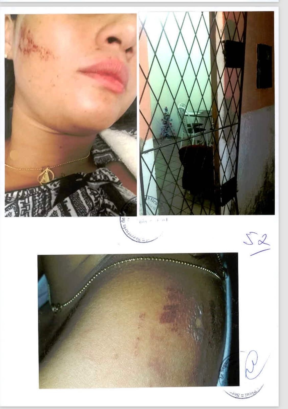 Outras marcas das agressões