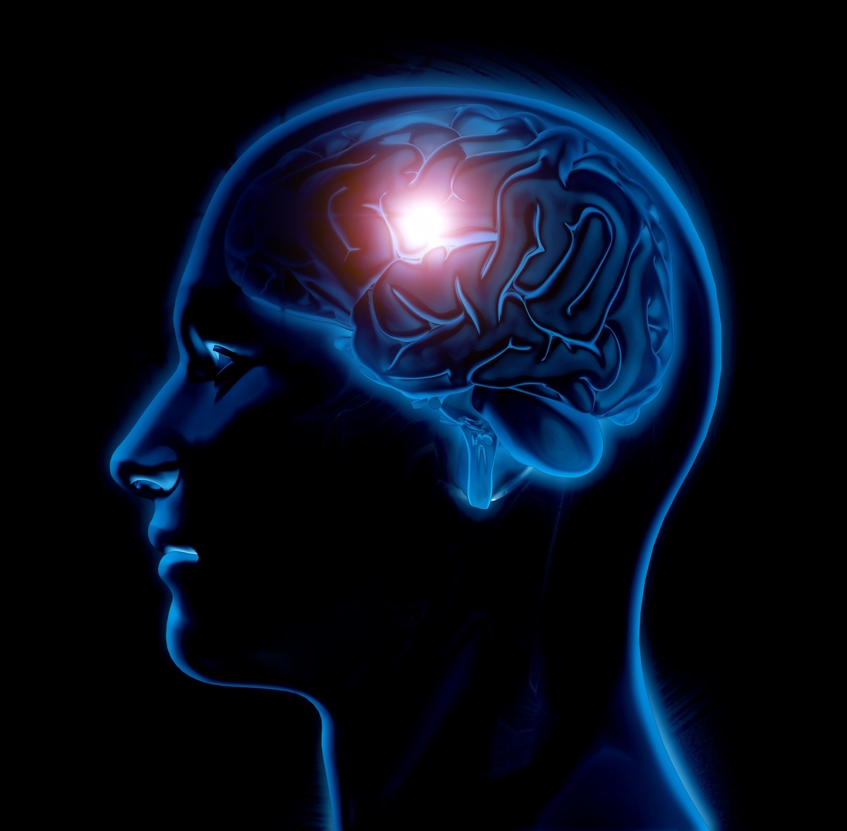 Neurologista destaca pressão alta e diabetes descontrolada como causas frequentes do AVC
