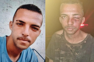 O jovem agora aguarda a ação das autoridades para que os responsáveis por esse crime sejam identificados e presos. A polícia segue investigando o caso. (Foto: Reprodução)