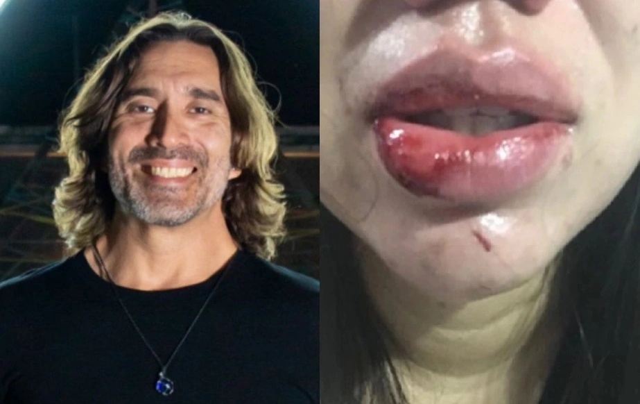 Renato Lee é acusado de agredir esposa. Boletim de Ocorrência foi registrado