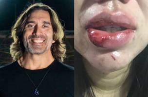 Renato Lee é acusado de agredir esposa. Boletim de Ocorrência foi registrado (Foto: Reprodução)