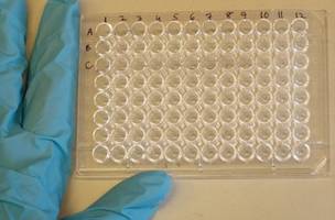 O teste imunoenzimático do tipo ELISA pode ser adaptado para outras tecnologias automatizadas e testes rápidos do tipo point of care (Foto: Jeffrey M. Vinocur/Wikimedia Commons)