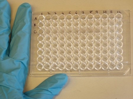 O teste imunoenzimático do tipo ELISA pode ser adaptado para outras tecnologias automatizadas e testes rápidos do tipo point of care