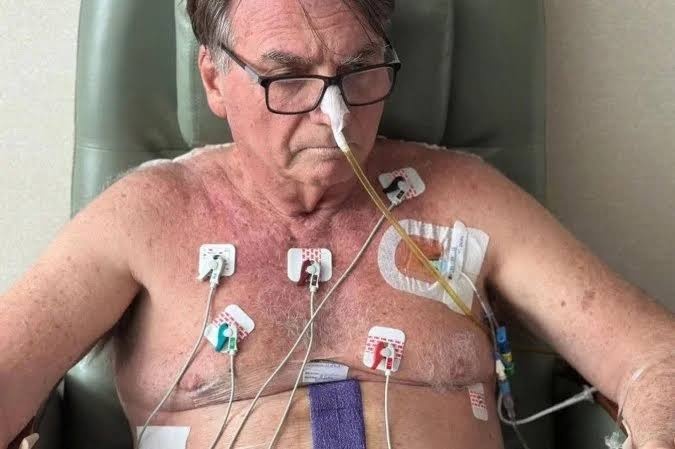 Bolsonaro segue internado na UTI