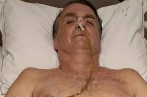 Ex-presidente Jair Bolsonaro segue internado. (Foto: Reprodução | Platobr Politica)