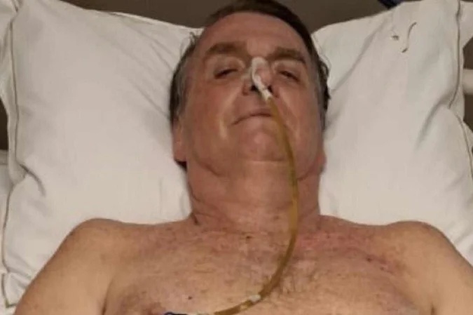 Ex-presidente Jair Bolsonaro segue internado.