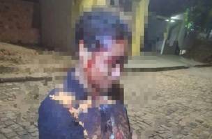 A vítima pediu socorro à uma viatura da Polícia Militar que passava na região (Foto: Divulgação/PM-PI)