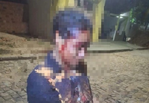 A vítima pediu socorro à uma viatura da Polícia Militar que passava na região