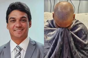 Bruno Neto (MDB) comemorou o sucesso de transplante de medula óssea na redes sociais (Foto: Reprodução)