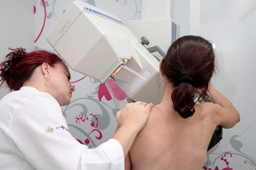 Cirurgia reparadora de mama