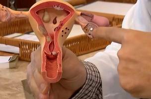 Endometriose: diagnóstico da doença cresceu 30% entre 2022 e 2024 (Foto: Reprodução/TV Brasil)