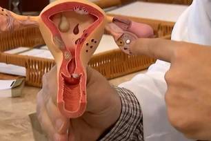Endometriose: diagnóstico da doença cresceu 30% entre 2022 e 2024 (Foto: Reprodução/TV Brasil)