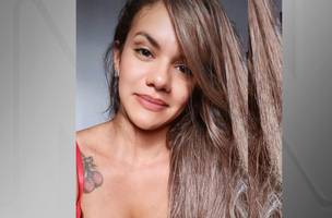 Juliana Garcia passará por cirurgia de reconstrução facial (Foto: Reprodução)