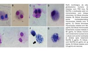 Pesquisa da UFPI divulga resultados positivos sobre estudo de tratamento contra câncer cerebral (Foto: Reprodução (UFPI))